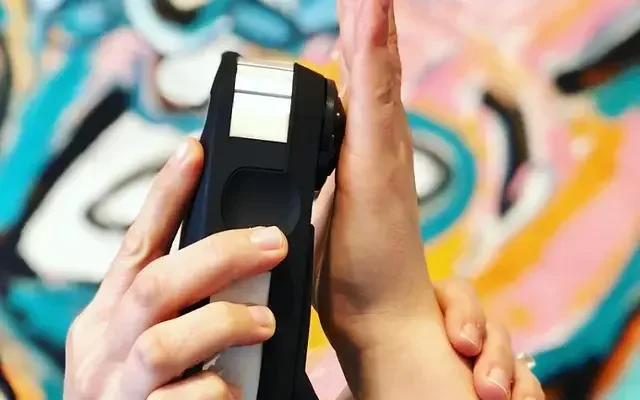 OligoScan device measuring trace elements through the skin