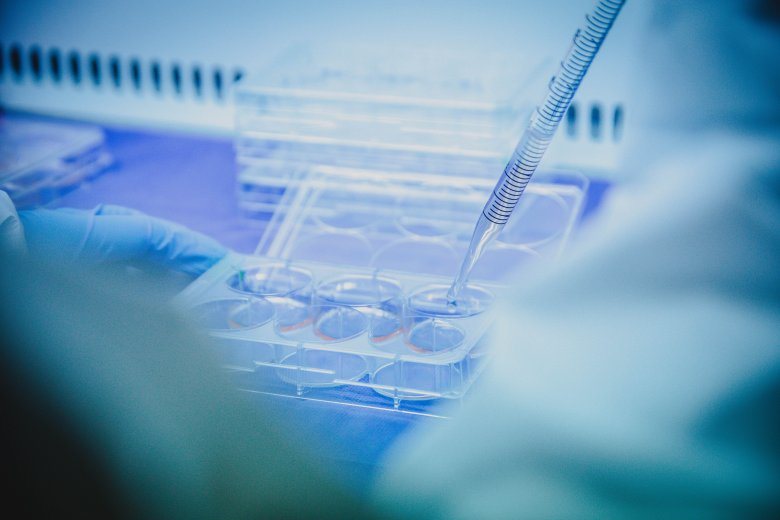 Aislamiento de células madre mesenquimales en condiciones de laboratorio